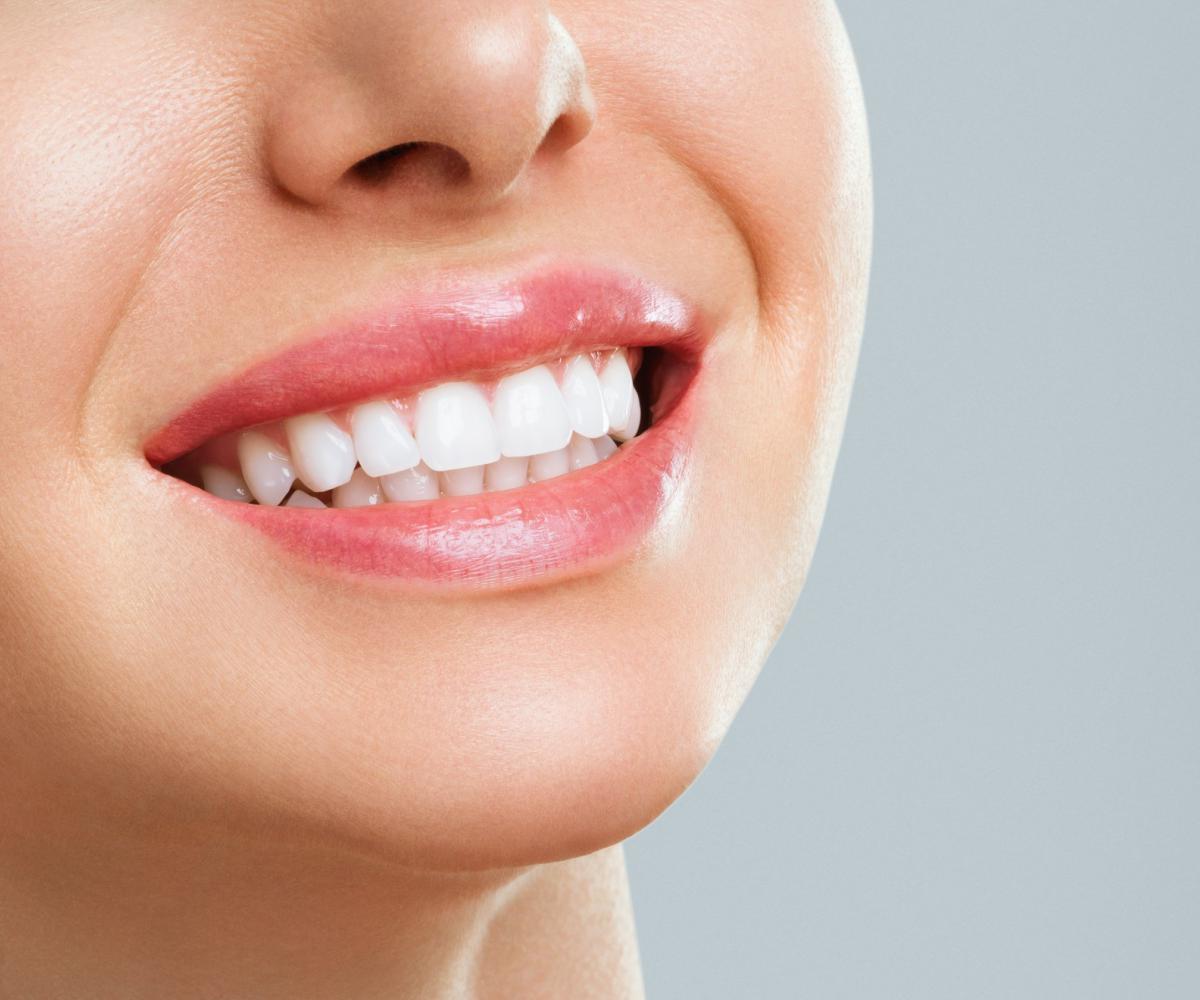 Lente de Contato Dental - Dentística Estética - Copacabana Odonto