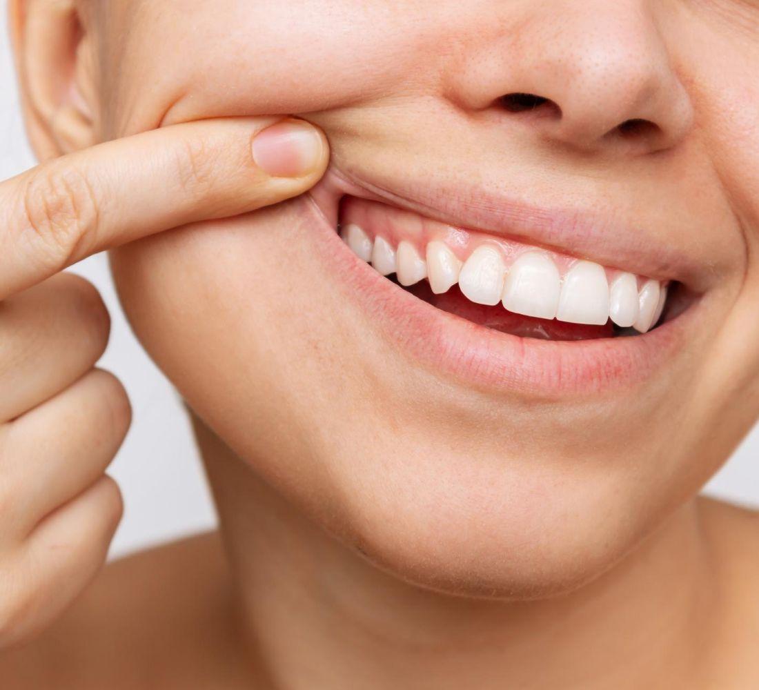 Transforme seu sorriso com a excelência em tratamentos de Periodontia da Copacabana Odonto