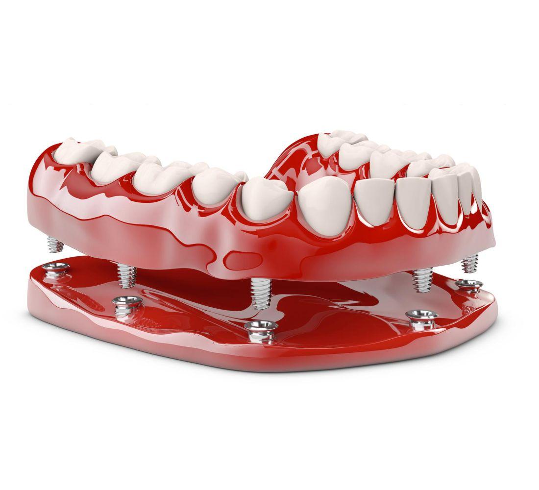 Prótese Dentária - Tratamento Odontológico - Copacabana Odonto